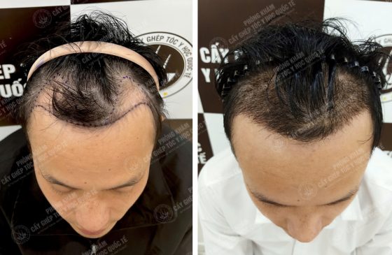Tô Thành An