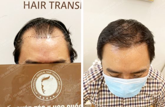 Đỗ Gia Bảo