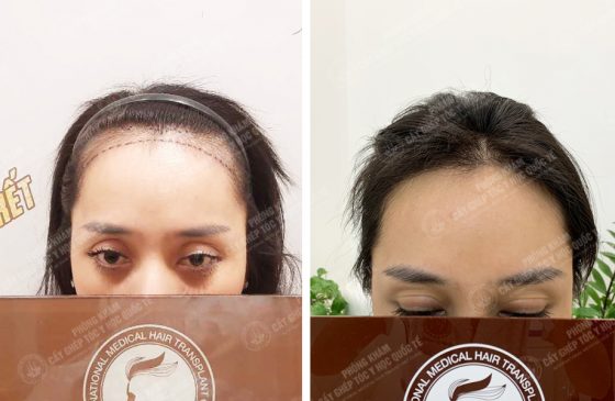 Lê Thị Nguyệt