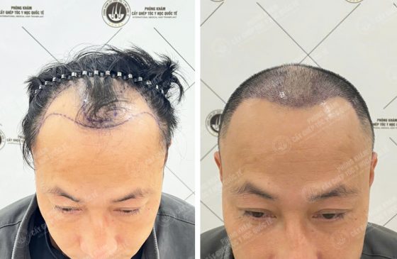 Đinh Văn Sửu