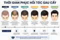 Thời gian phục hồi tóc sau cấy