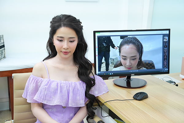 Thời gian phục hồi tóc sau cấy