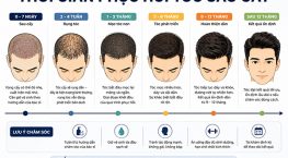 Thời gian phục hồi tóc sau cấy: Lộ trình từ 7 ngày đến 12 tháng