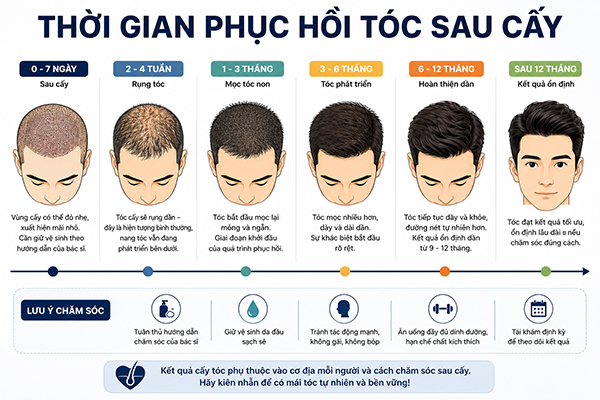 Thời gian phục hồi tóc sau cấy
