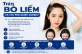 Trán bò liếm có cấy tóc được không?