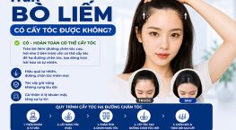 Trán bò liếm có cấy tóc được không? Những điều cần biết