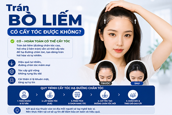 Trán bò liếm có cấy tóc được không?