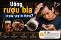 [Bác sĩ giải đáp]: Uống rượu bia có gây rụng tóc không?