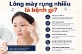 Lông mày rụng nhiều là bệnh gì?
