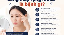 Lông mày rụng nhiều là bệnh gì? 5 Nguyên nhân thường gặp
