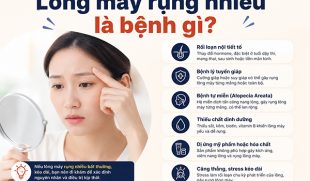 Lông mày rụng nhiều là bệnh gì? 5 Nguyên nhân thường gặp