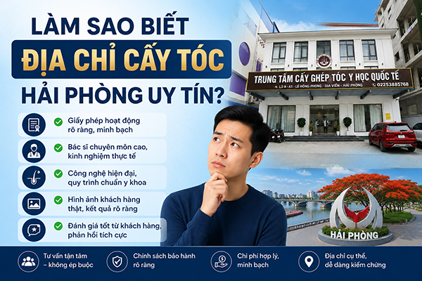 Làm sao biết địa chỉ cấy tóc Hải Phòng uy tín