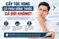 Cấy tóc xong có phải uống thuốc cả đời không?