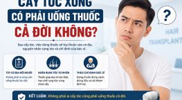 Cấy tóc xong có phải uống thuốc cả đời không? Bác sĩ giải đáp chi tiết
