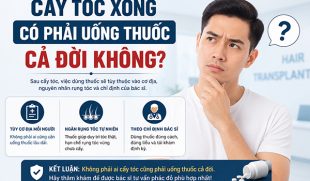 Cấy tóc xong có phải uống thuốc cả đời không? Bác sĩ giải đáp chi tiết
