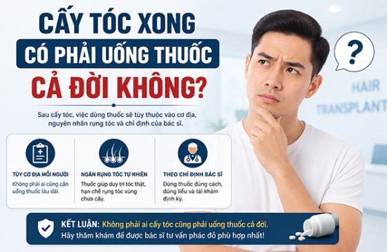 Cấy tóc xong có phải uống thuốc cả đời không?