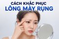 TOP 7 Cách khắc phục lông mày rụng có thể bạn chưa biết
