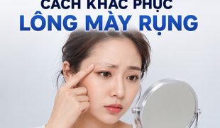 TOP 7 Cách khắc phục lông mày rụng có thể bạn chưa biết
