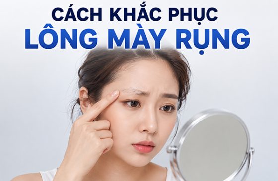 TOP 7 Cách khắc phục lông mày rụng có thể bạn chưa biết