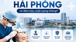 Cấy tóc tại Hải Phòng có đảm bảo chất lượng không?