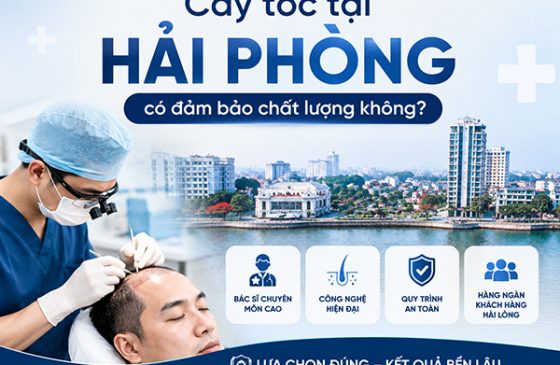 Cấy tóc tại Hải Phòng có đảm bảo chất lượng không?