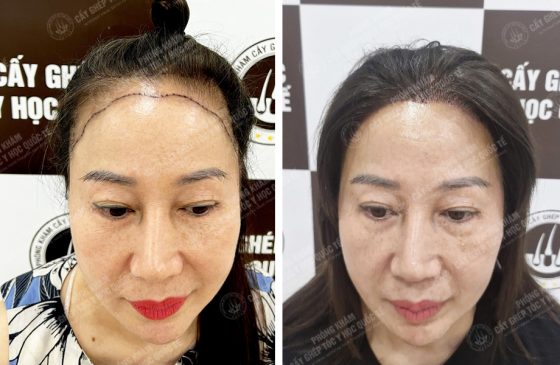 Trần Thị Bích