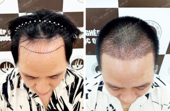 Vũ Hồng Duy