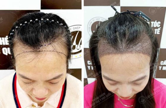 Trần Thị Thu Hương