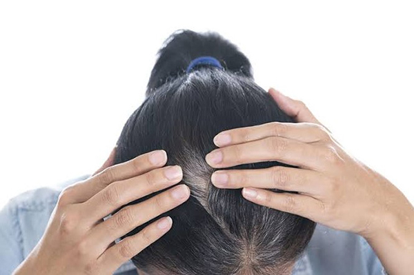 Vì sao lông mày bị rụng khi mang thai?