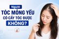 Người tóc mỏng yếu có cấy tóc được không?