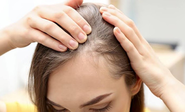 Người tóc mỏng yếu có cấy tóc được không?