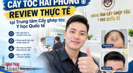 Cấy tóc Hải Phòng review thực tế tại Trung tâm Cấy ghép tóc Y học Quốc tế