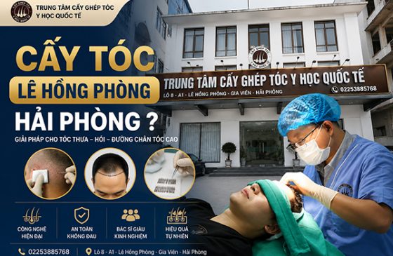 Cấy tóc Lê Hồng Phong Hải Phòng