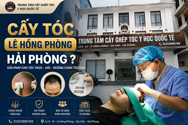 Cấy tóc Lê Hồng Phong Hải Phòng