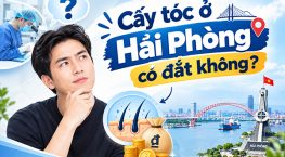 Cấy tóc ở Hải Phòng có đắt không? Những yếu tố quyết định nên biết
