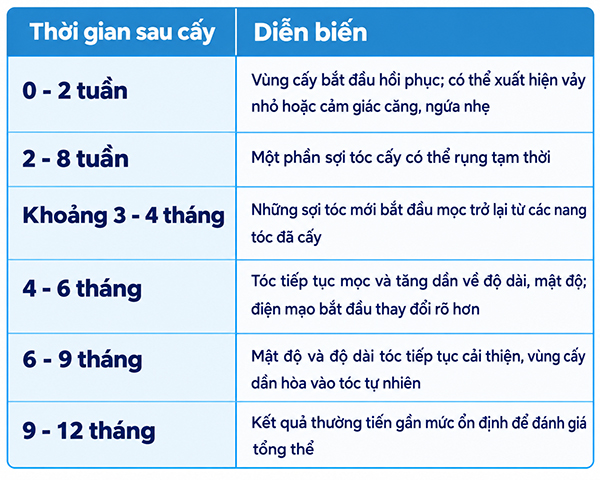 Có nên cấy tóc khi chưa hói nhiều không