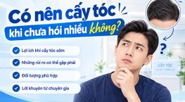 [Giải đáp]: Có nên cấy tóc khi chưa hói nhiều không?