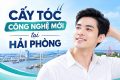 Công nghệ cấy tóc mới tại hải phòng