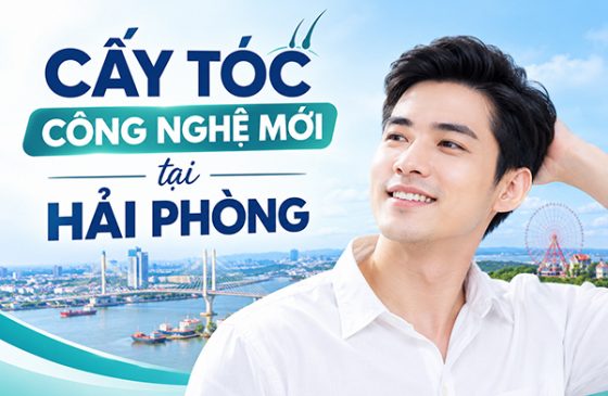 Công nghệ cấy tóc mới tại hải phòng