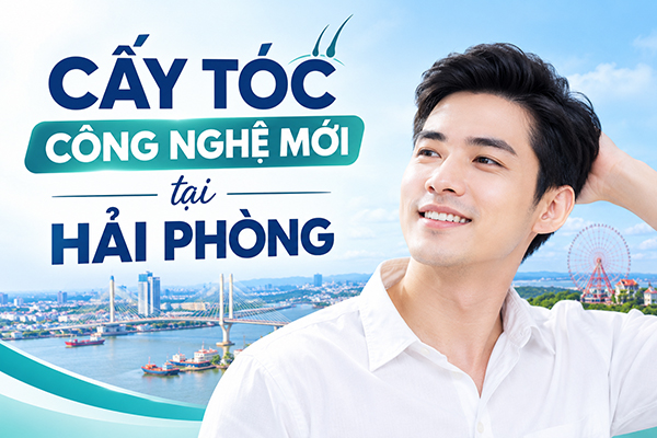 Công nghệ cấy tóc mới tại hải phòng