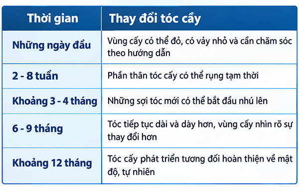 Các mốc thời gian mọc tóc sau cấy