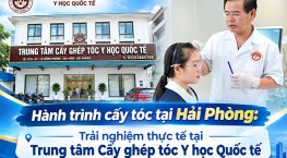 Hành trình cấy tóc tại Hải Phòng: Trải nghiệm thực tế tại Trung tâm Cấy ghép tóc Y học Quốc tế