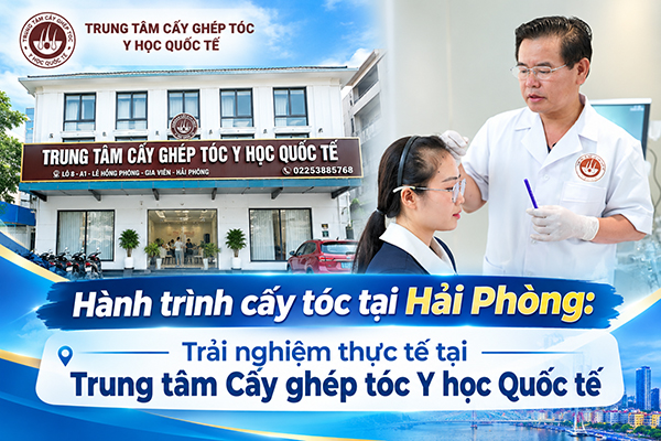Hành trình cấy tóc tại Hải Phòng: Trải nghiệm thực tế