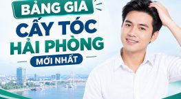 [Cập nhật]: Bảng giá cấy tóc Hải Phòng mới nhất
