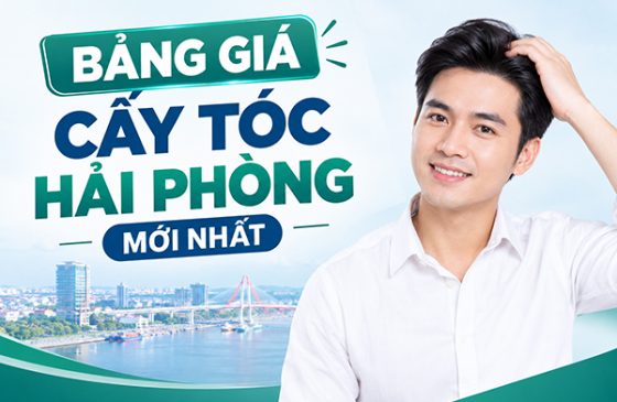 [Cập nhật]: Bảng giá cấy tóc Hải Phòng mới nhất
