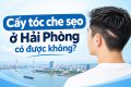 [Tìm Hiểu] : Cấy tóc che sẹo ở Hải Phòng có được không?