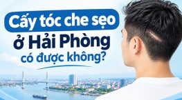 Cấy tóc che sẹo ở Hải Phòng có được không? Quy trình, chi phí và lưu ý