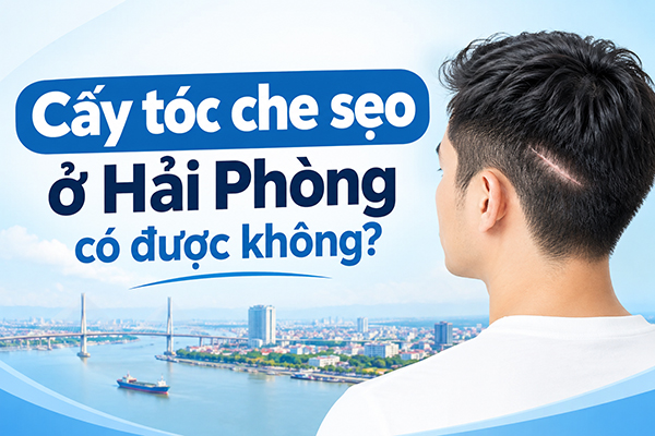 [Tìm Hiểu] : Cấy tóc che sẹo ở Hải Phòng có được không?