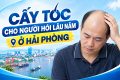 Cấy tóc cho người hói lâu năm ở Hải Phòng có được không?