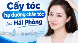 [Tìm Hiểu] : Cấy tóc hạ đường chân tóc tại Hải Phòng